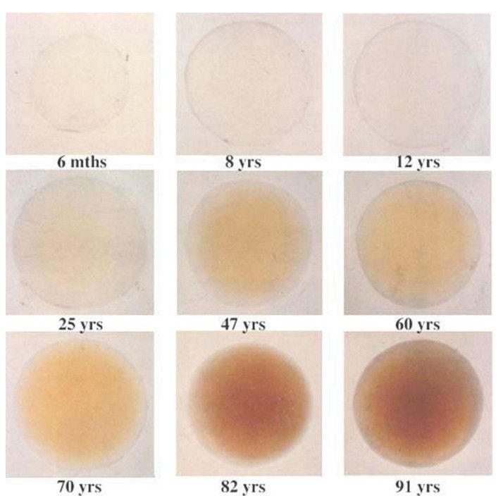 human crystalline lens